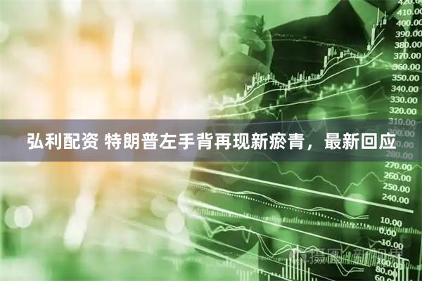 弘利配资 特朗普左手背再现新瘀青，最新回应